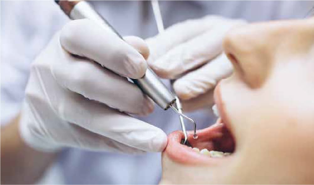Healthcare-Dental Irrigation
